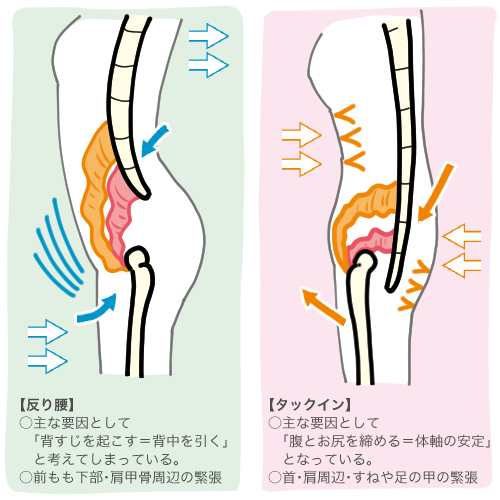 「反り腰」と「タックイン」