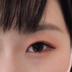 奥二重1.jpg